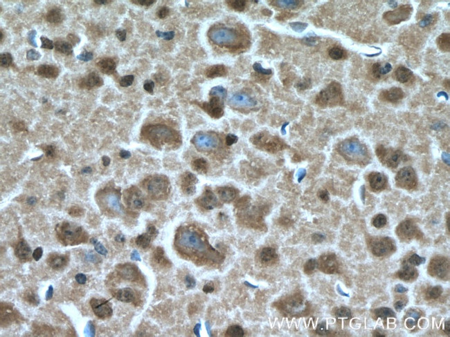 ARL13B Antibody in Immunohistochemistry (Paraffin) (IHC (P))