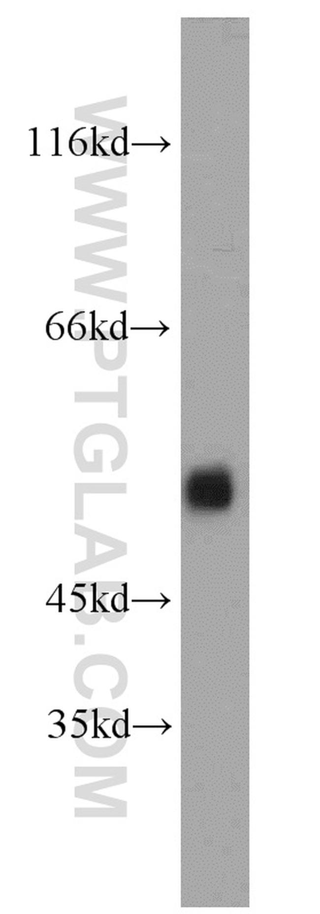 ARL13B Antibody in Western Blot (WB)