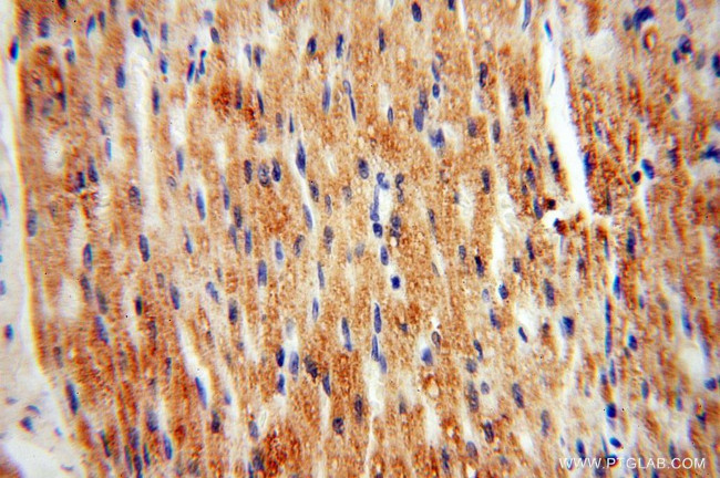 USMG5 Antibody in Immunohistochemistry (Paraffin) (IHC (P))