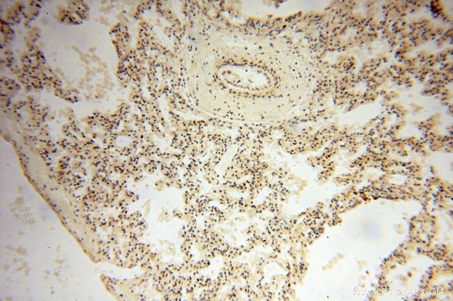 USMG5 Antibody in Immunohistochemistry (Paraffin) (IHC (P))