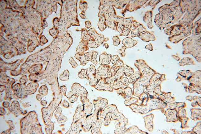 USMG5 Antibody in Immunohistochemistry (Paraffin) (IHC (P))