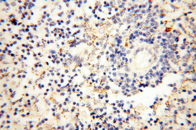 EB1 Antibody in Immunohistochemistry (Paraffin) (IHC (P))