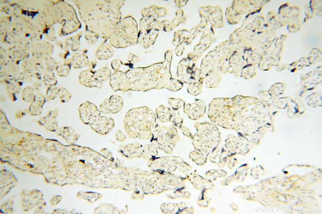 EB1 Antibody in Immunohistochemistry (Paraffin) (IHC (P))