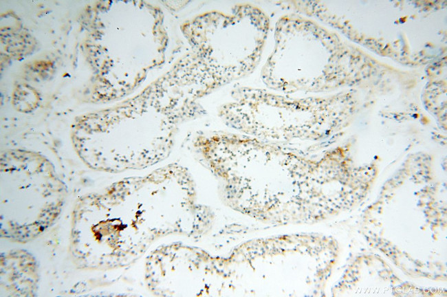 EB1 Antibody in Immunohistochemistry (Paraffin) (IHC (P))