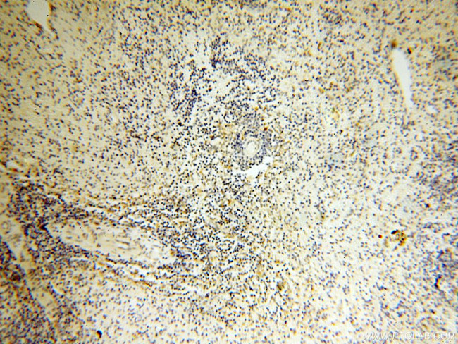 EB1 Antibody in Immunohistochemistry (Paraffin) (IHC (P))