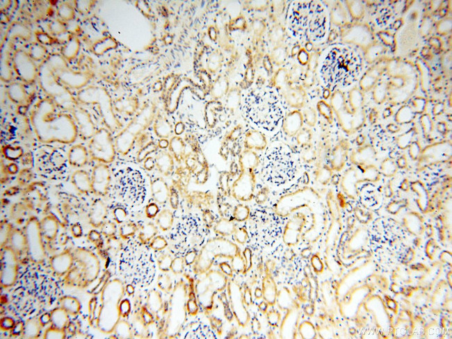 EB1 Antibody in Immunohistochemistry (Paraffin) (IHC (P))