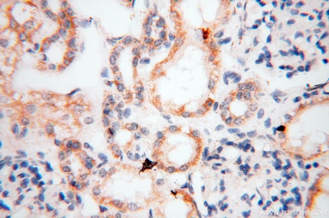 EB1 Antibody in Immunohistochemistry (Paraffin) (IHC (P))