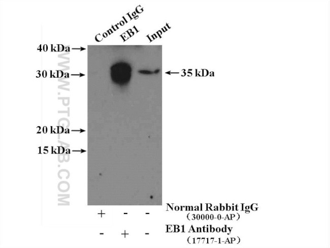 EB1 Antibody in Immunoprecipitation (IP)