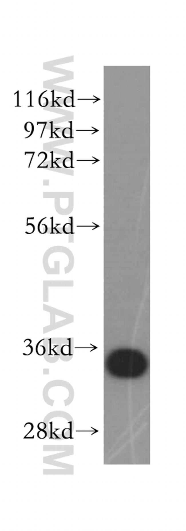 EB1 Antibody in Western Blot (WB)