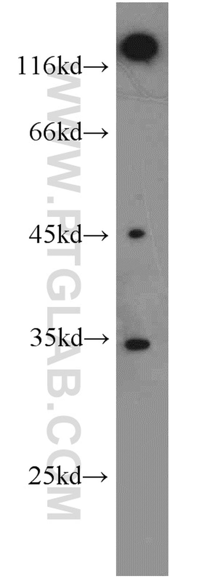 EB1 Antibody in Western Blot (WB)