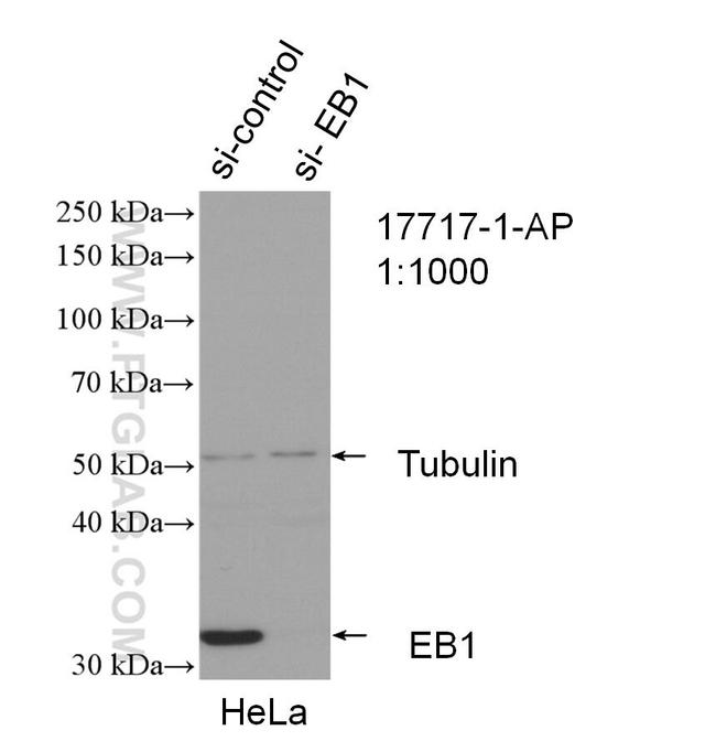 EB1 Antibody in Western Blot (WB)