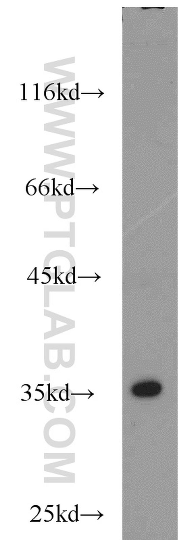 EB1 Antibody in Western Blot (WB)