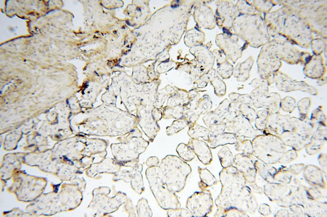 CSK Antibody in Immunohistochemistry (Paraffin) (IHC (P))