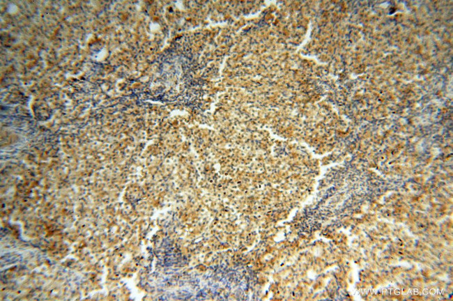 CSK Antibody in Immunohistochemistry (Paraffin) (IHC (P))