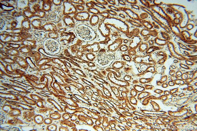 CSK Antibody in Immunohistochemistry (Paraffin) (IHC (P))