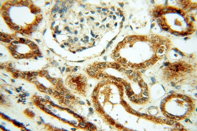 CSK Antibody in Immunohistochemistry (Paraffin) (IHC (P))