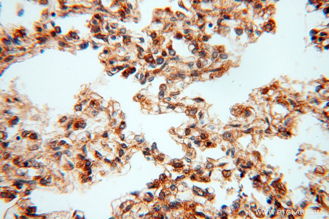 CSK Antibody in Immunohistochemistry (Paraffin) (IHC (P))