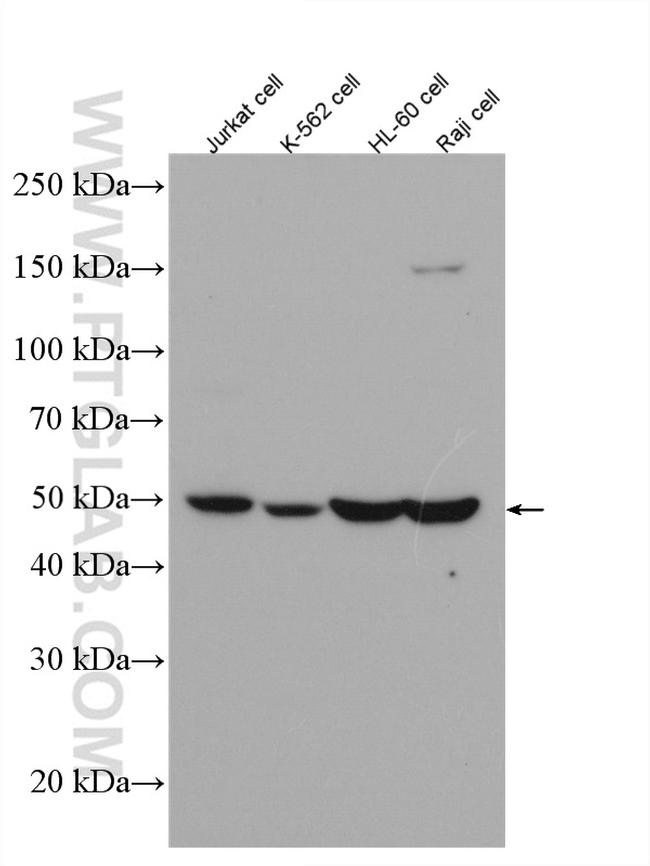 CSK Antibody in Western Blot (WB)