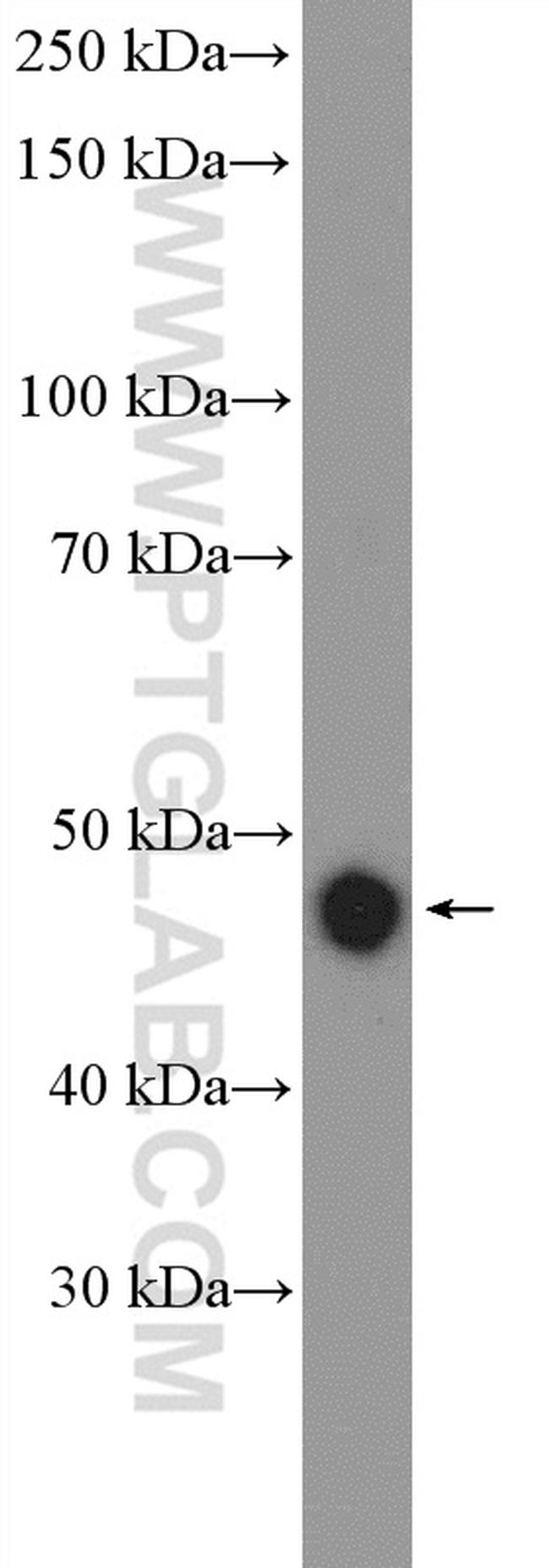 CSK Antibody in Western Blot (WB)