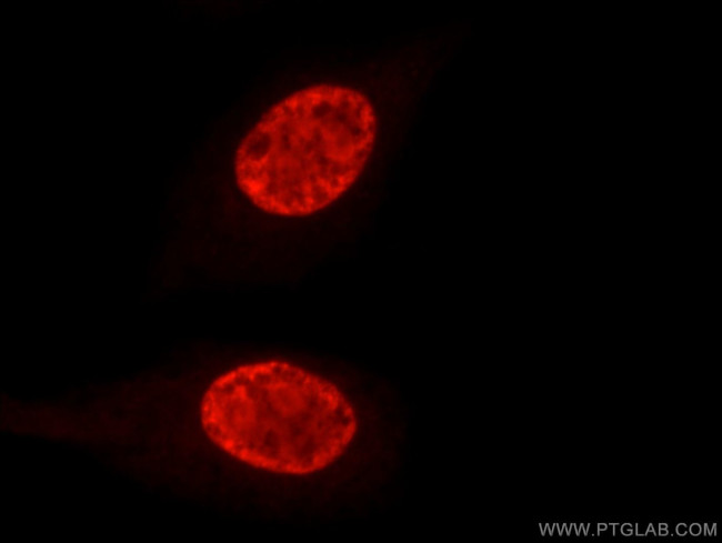 DHX9 Antibody in Immunocytochemistry (ICC/IF)