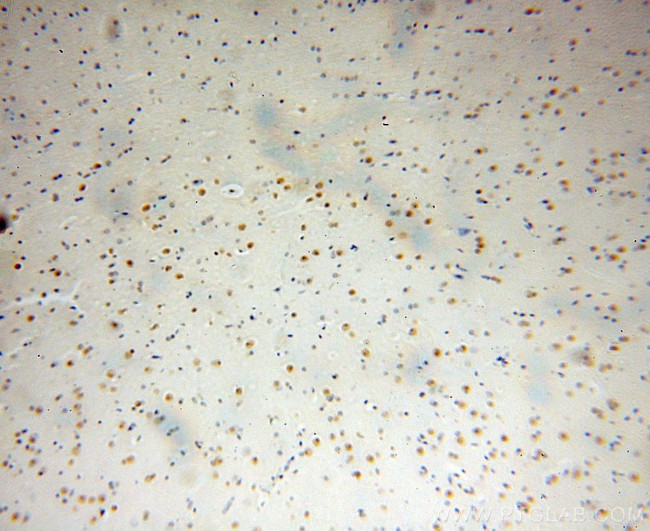 DHX9 Antibody in Immunohistochemistry (Paraffin) (IHC (P))