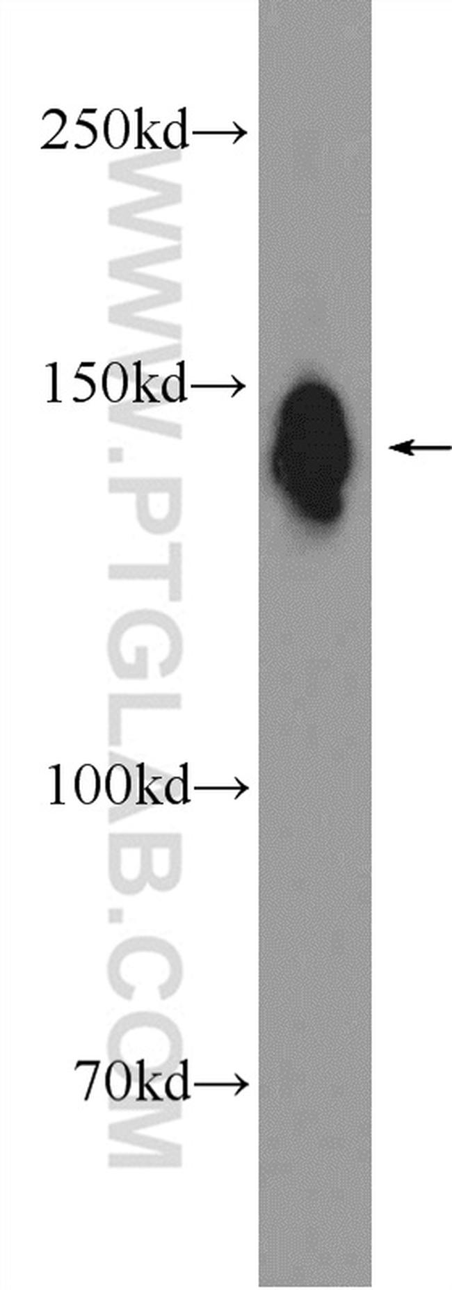 DHX9 Antibody in Western Blot (WB)