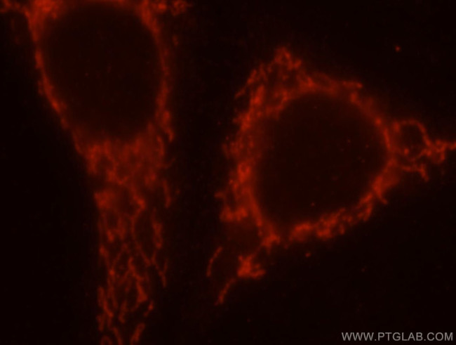 SAMD4B Antibody in Immunocytochemistry (ICC/IF)