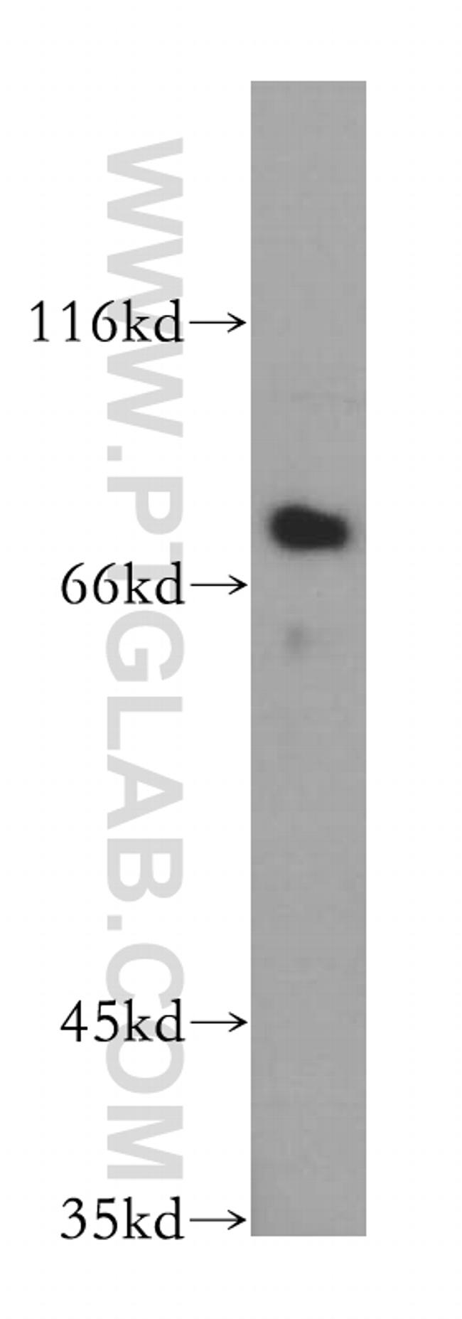 SAMD4B Antibody in Western Blot (WB)