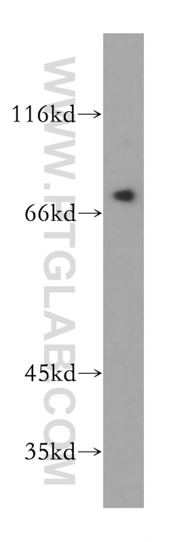 SAMD4B Antibody in Western Blot (WB)