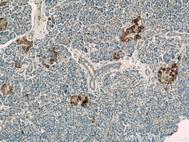 ATP6V1F Antibody in Immunohistochemistry (Paraffin) (IHC (P))