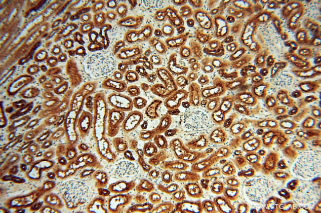 ATP6V1F Antibody in Immunohistochemistry (Paraffin) (IHC (P))