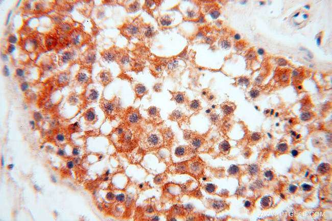 ATP6V1F Antibody in Immunohistochemistry (Paraffin) (IHC (P))