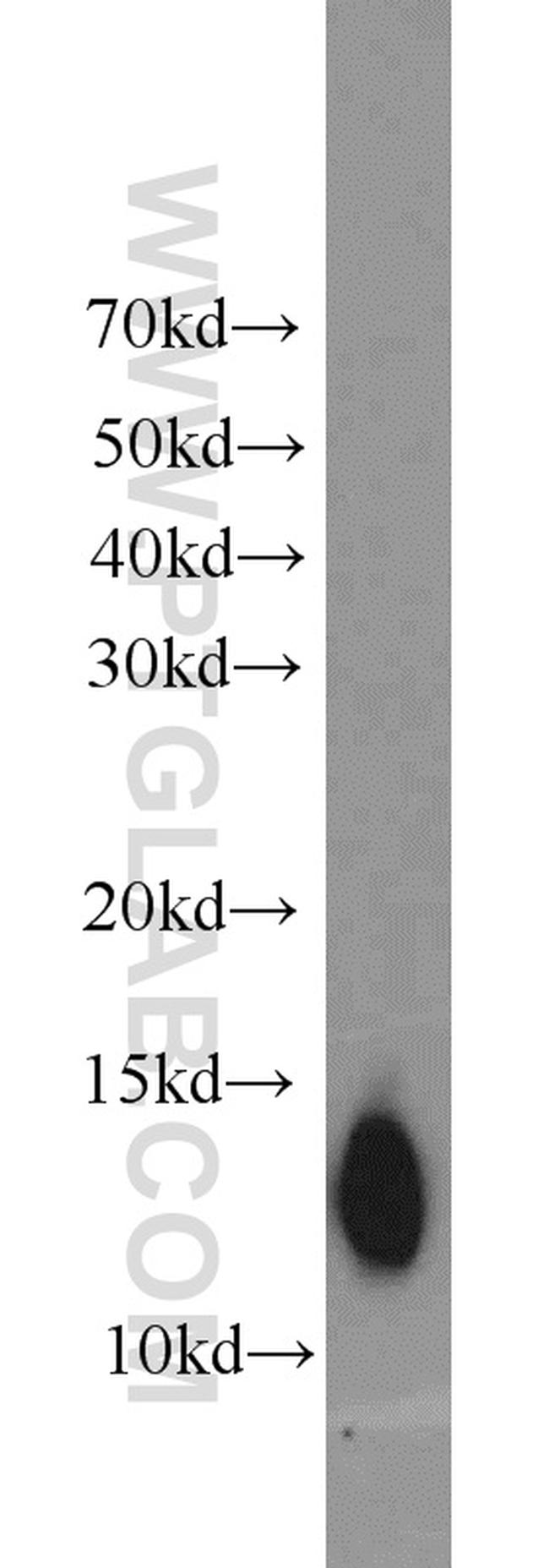 ATP6V1F Antibody in Western Blot (WB)