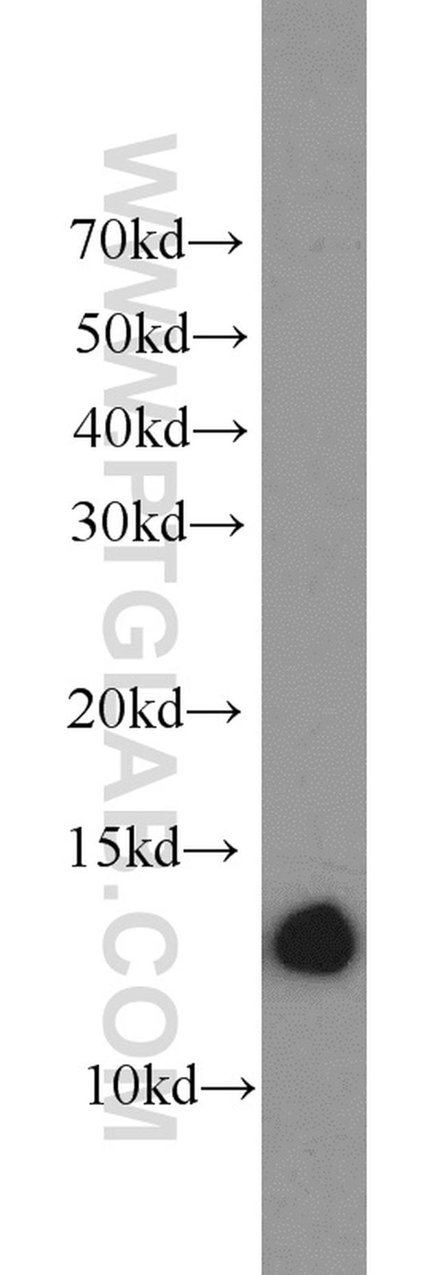 ATP6V1F Antibody in Western Blot (WB)