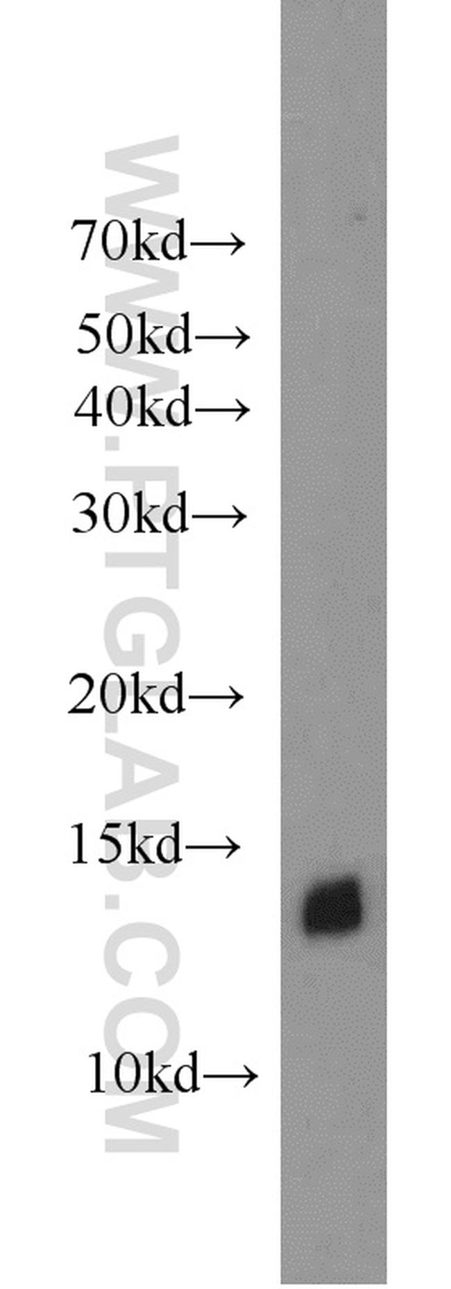 ATP6V1F Antibody in Western Blot (WB)