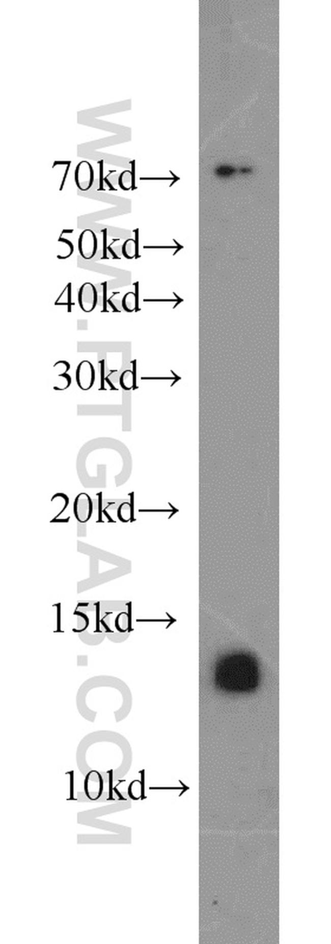 ATP6V1F Antibody in Western Blot (WB)