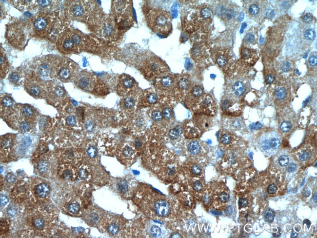 BLVRB Antibody in Immunohistochemistry (Paraffin) (IHC (P))