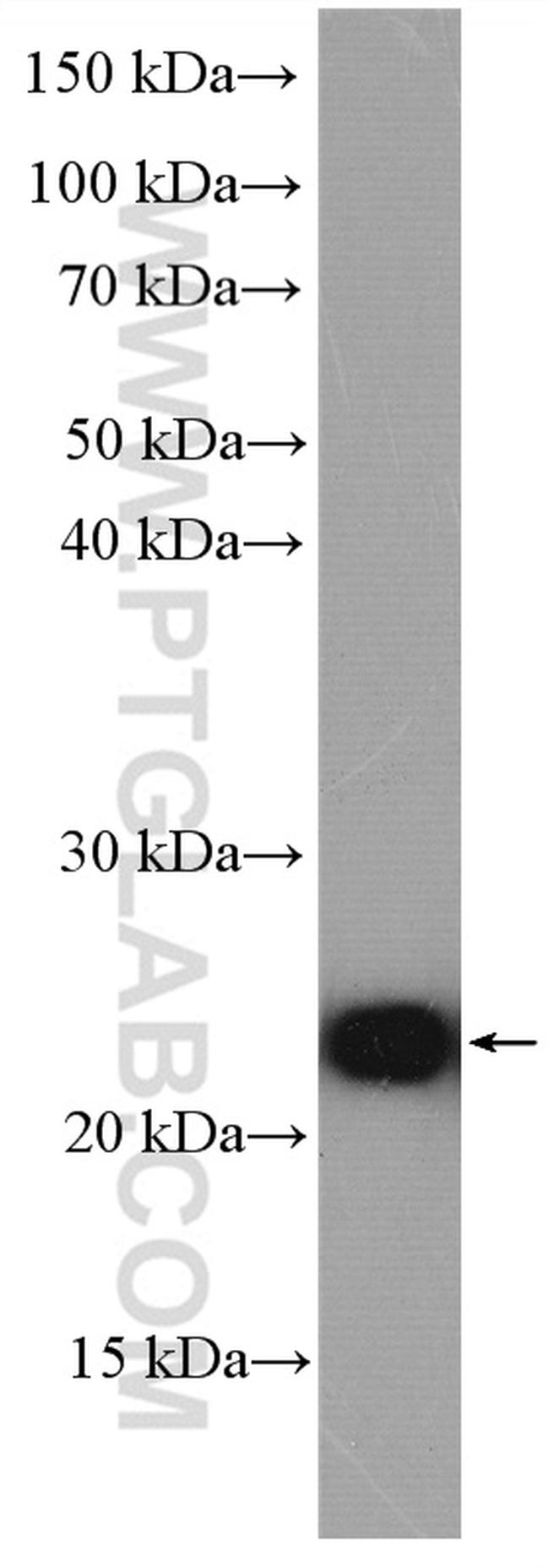 BLVRB Antibody in Western Blot (WB)