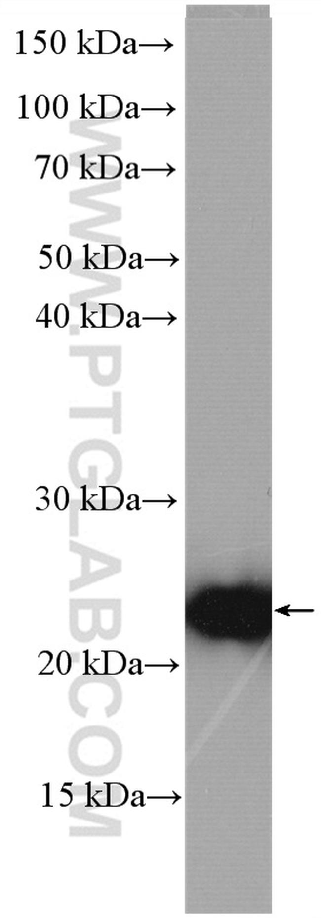 BLVRB Antibody in Western Blot (WB)