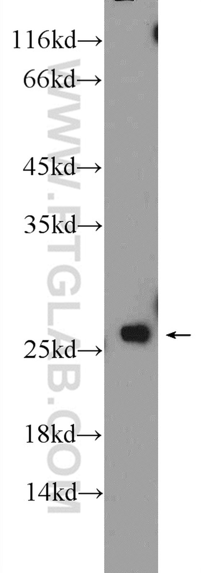 BLVRB Antibody in Western Blot (WB)