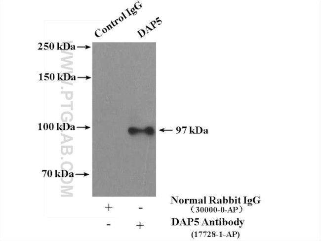 DAP5 Antibody in Immunoprecipitation (IP)