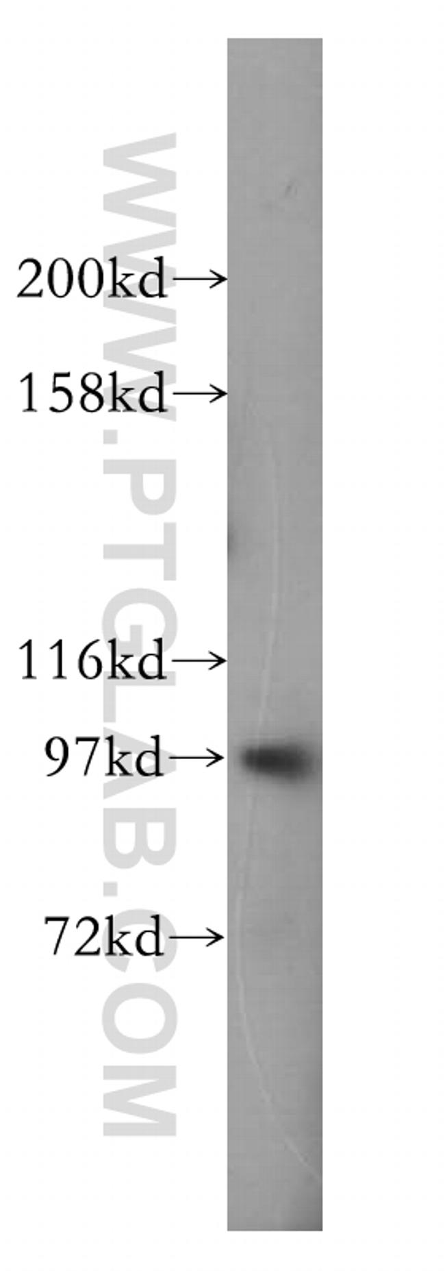 DAP5 Antibody in Western Blot (WB)