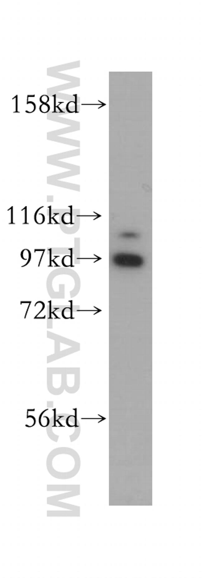 DAP5 Antibody in Western Blot (WB)