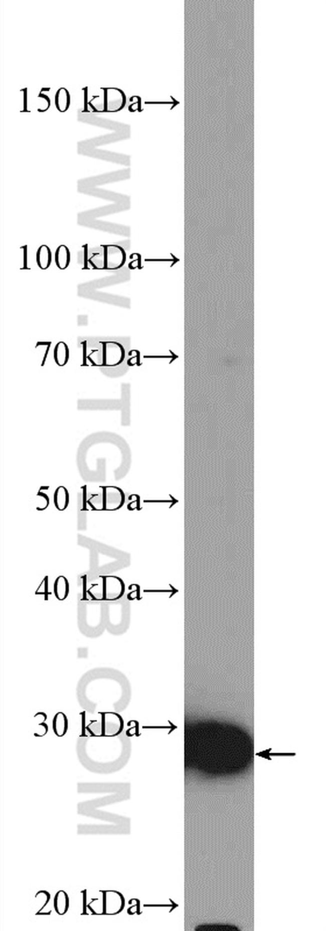 BCL10 Antibody in Western Blot (WB)