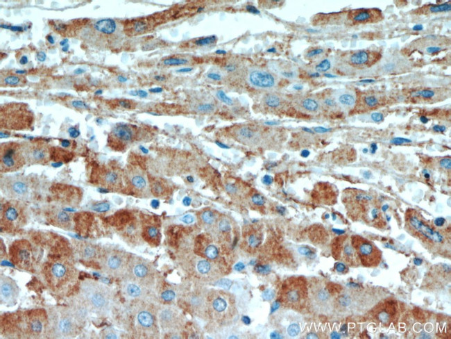 EDC4 Antibody in Immunohistochemistry (Paraffin) (IHC (P))