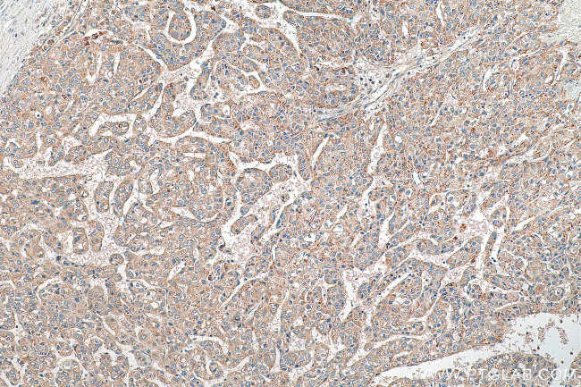 EDC4 Antibody in Immunohistochemistry (Paraffin) (IHC (P))