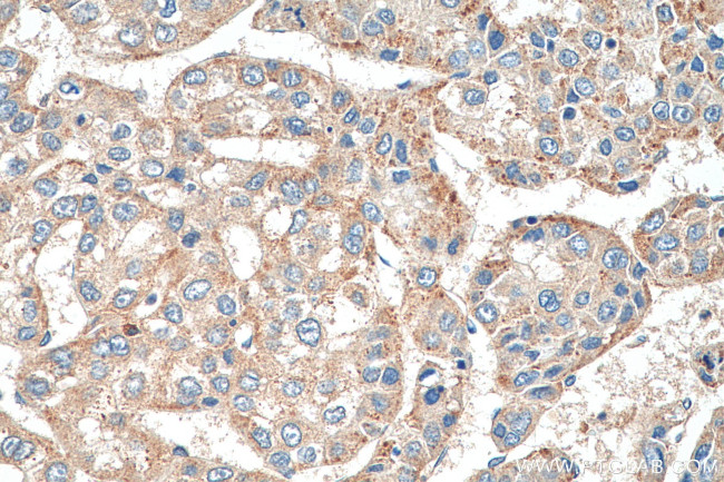 EDC4 Antibody in Immunohistochemistry (Paraffin) (IHC (P))