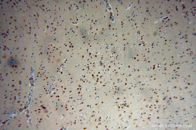 CPSF2 Antibody in Immunohistochemistry (Paraffin) (IHC (P))