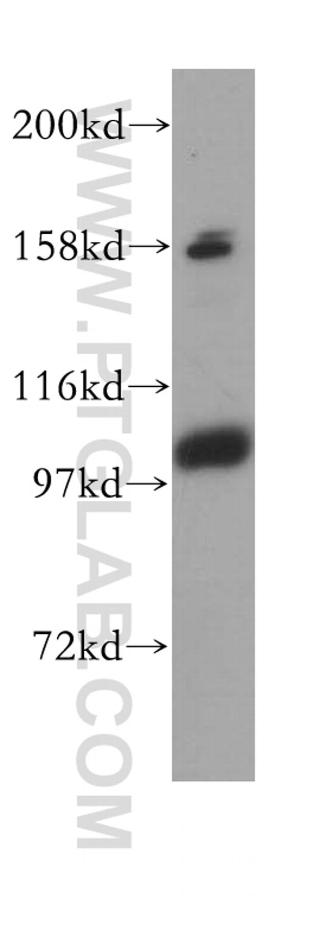 CPSF2 Antibody in Western Blot (WB)