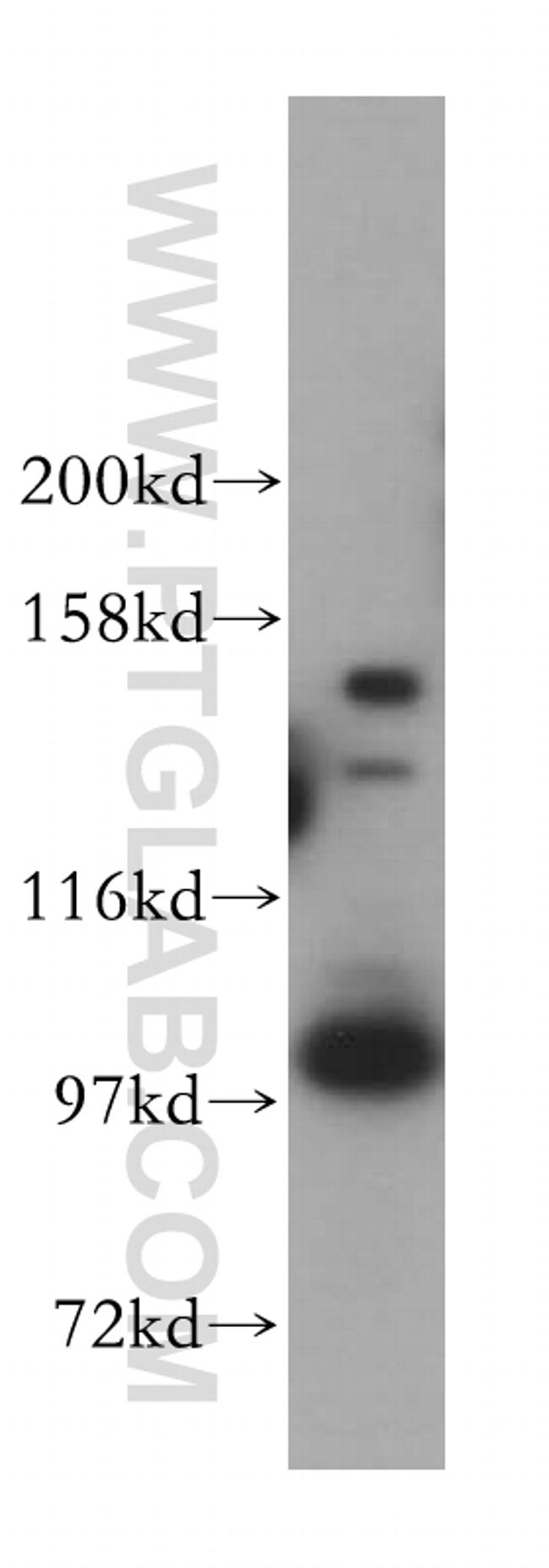 CPSF2 Antibody in Western Blot (WB)